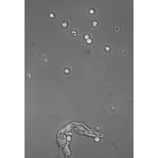 Hund Microscop Medicus PH Plan, trino, 100x-1000x