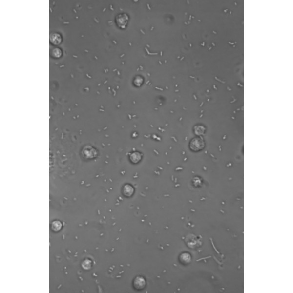 Hund Microscop Medicus PH Plan, trino, 100x-1000x