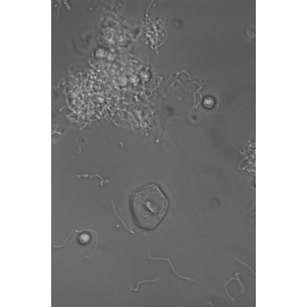Hund Microscop Medicus PH Plan, trino, 100x-1000x