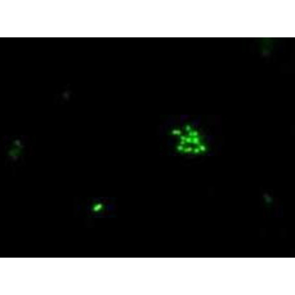 Hund Microscop H 600 Wilo-brew,  bino, 100x - 630x