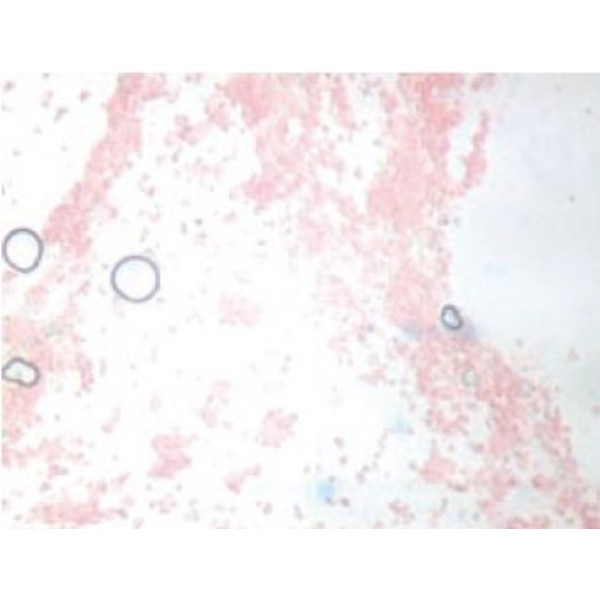 Novex Microscop BTP 86.091-DF-DFLED, trinocular