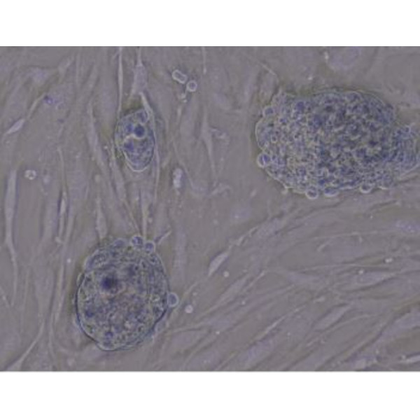 Evident Olympus Microscop trinocular CKX53 100X, 200X, 400X, IPC / IVC masa x/y