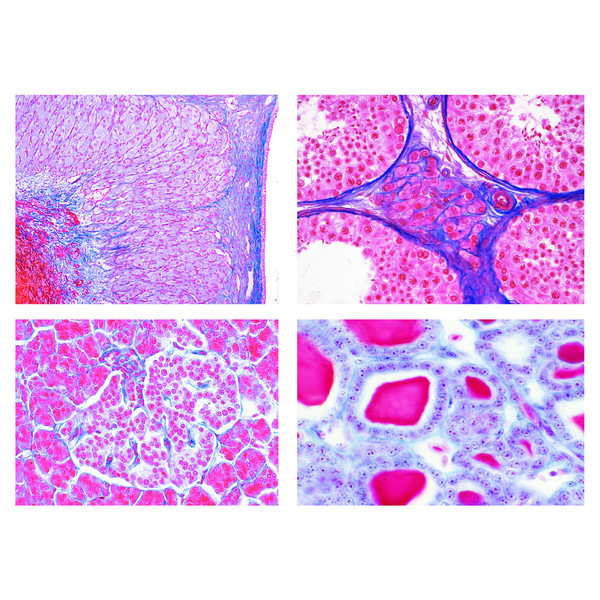 LIEDER Set 7 preparate microscop, nr. IV, organe hormonale si functii hormonale, pentru scoli gimnaziale