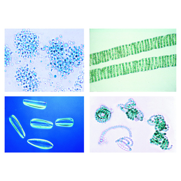 LIEDER Set 20 preparate microscop, nr II, mediu, poluarea mediului, probleme si rezultate