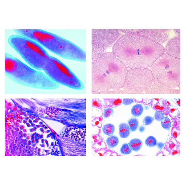 LIEDER Preparate microscop, 5 buc, mitoza si meioza, set II