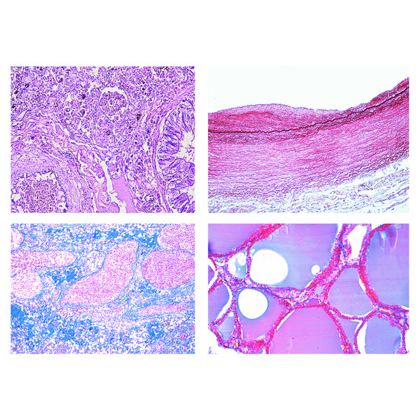 LIEDER Set de baza 50 preparate microscop, patologie umana