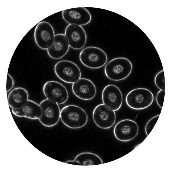 Optika Microscop Mikroskop B-510DKIVD, trino, darkfield, W-PLAN IOS, W-PLAN, 40x-1000x, IVD