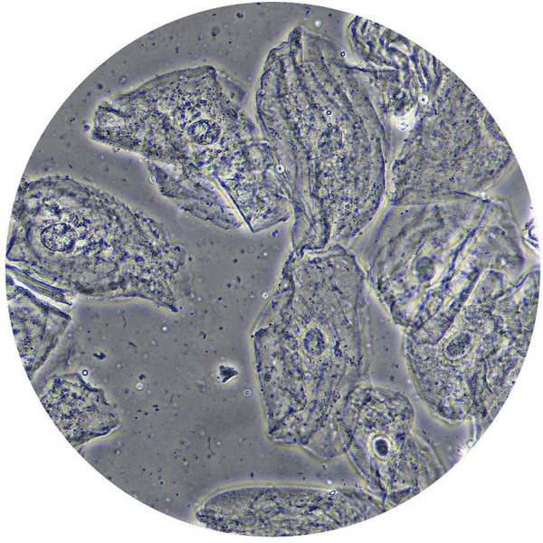 Optika Microscop Mikroskop B-510PHIVD, trino, phase, W-PLAN, IOS, 40x-1000x, EU, IVD