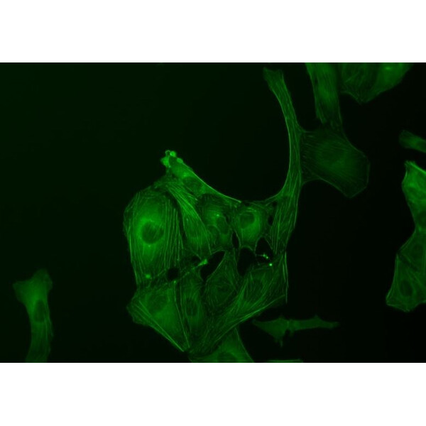 ZEISS Microscop inversat Primovert bino Ph1, 40x, 100x, Cond 0.3