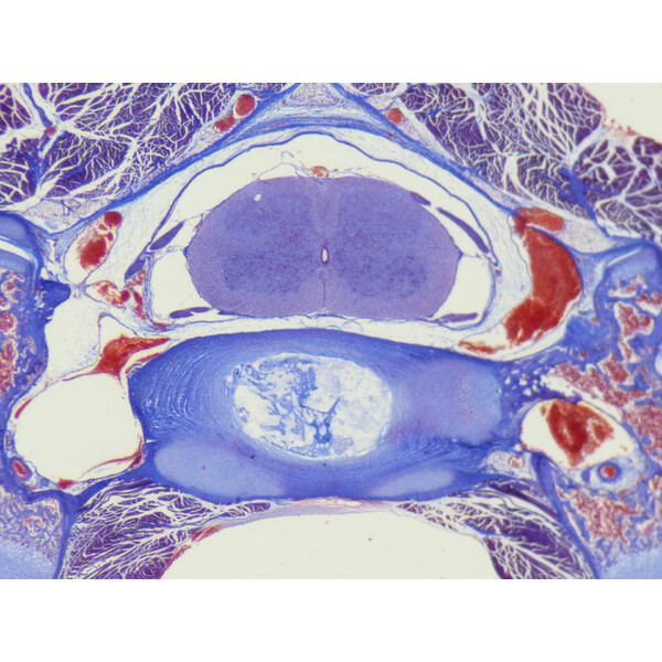ZEISS Microscopul stereoscopic zoom Stemi 355, C Edu, trino, w.d. 110 mm, 10x/23, 5,5:1 , 7,2x-40x, AL/DL, Spot C LED