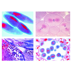 LIEDER Preparate microscop, 5 buc, mitoza si meioza, set II