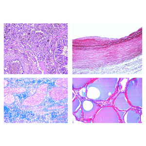 LIEDER Set de baza 50 preparate microscop, patologie umana