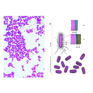 LIEDER Set Student de baza cu 6 preparate pentru microscop, bacterii