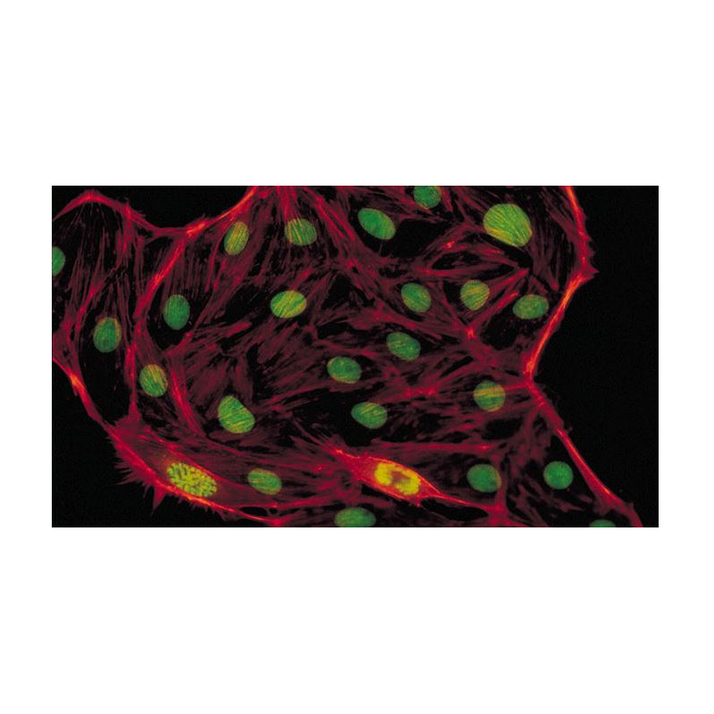 Evident Olympus Microscop CX41 fluorescenta, trino, 40x,100x, 400x