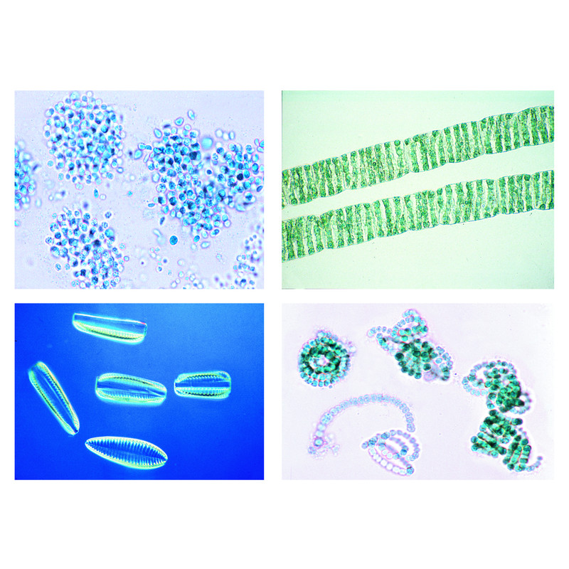 LIEDER Set 20 preparate microscop, nr II, mediu, poluarea mediului, probleme si rezultate