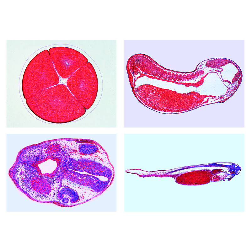 LIEDER Set 10 preparate microscop, embriologie broasca