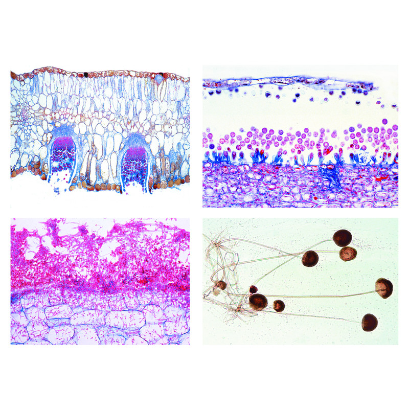 LIEDER Set 20 preparate microscop, agricultura si domeniu forestier, partea I, ciuperci parazite ca si cauza a imbolnavirii plantelor