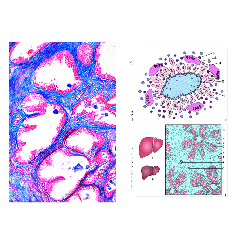 LIEDER Set Student, 6 lpreparate pentru microscop, patologie umana