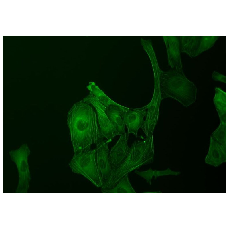 ZEISS Microscop inversat Primovert bino Ph1, 40x, 100x, Cond 0.3