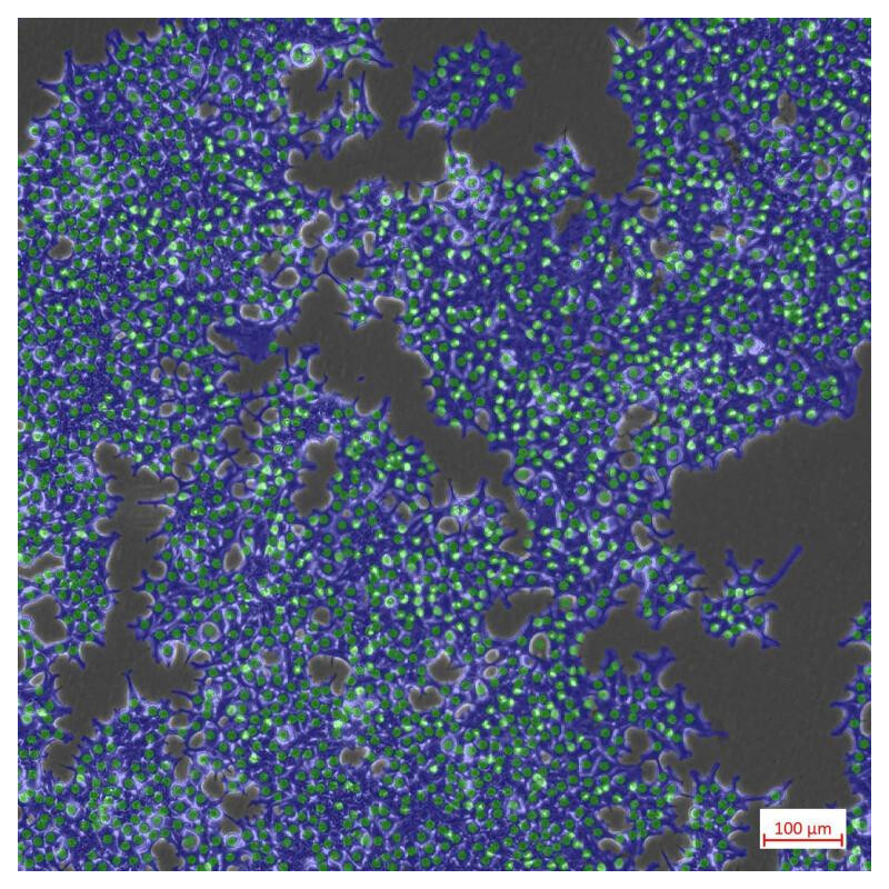 ZEISS Microscop Axiovert 5 Digital, PH, FL, 50-400x, Ph1, 0,4 NA, LED, 5 MP, color