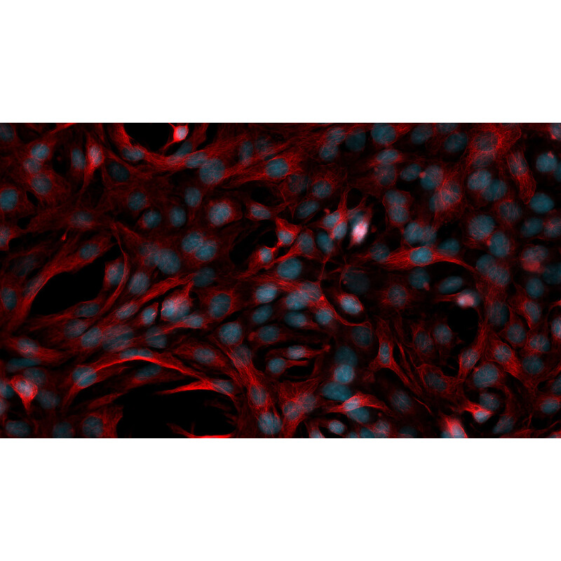 ZEISS Microscop Axiovert 5 Digital, PH, FL, 50-400x, Ph1, 0,4 NA, LED, 5 MP, color