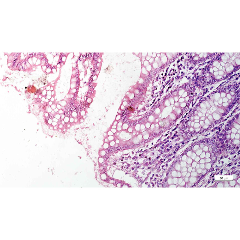 ZEISS Microscop Axiovert 5 Digital, PH, FL, 50-400x, Ph1, 0,4 NA, LED, 5 MP, color